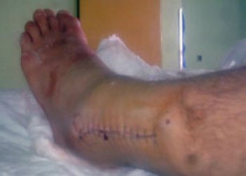 Petr Veselý mimo hru